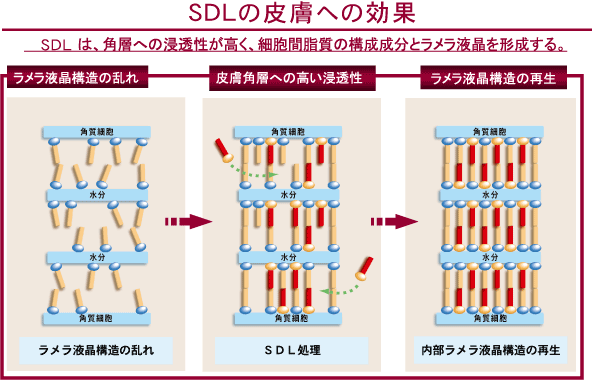 SDLの皮膚への効果