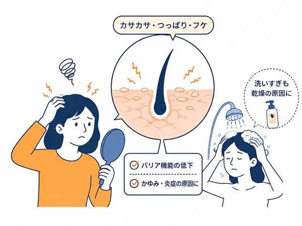 頭皮が乾燥しているイラスト